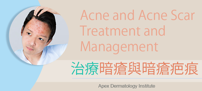 best acne dermatologist